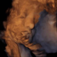 baby navelstreng